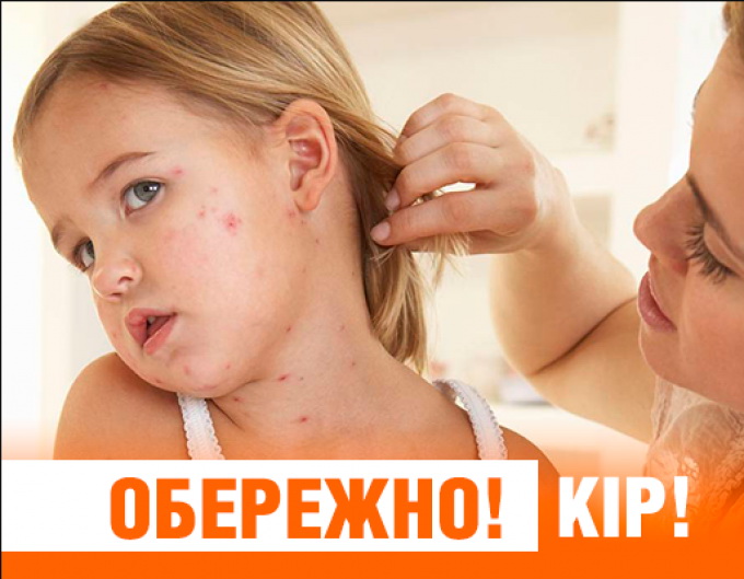 ОБЕРЕЖНО! КІР! ⋆ ДНЗ “Ніжинський професійний аграрний ліцей Чернігівської  області”